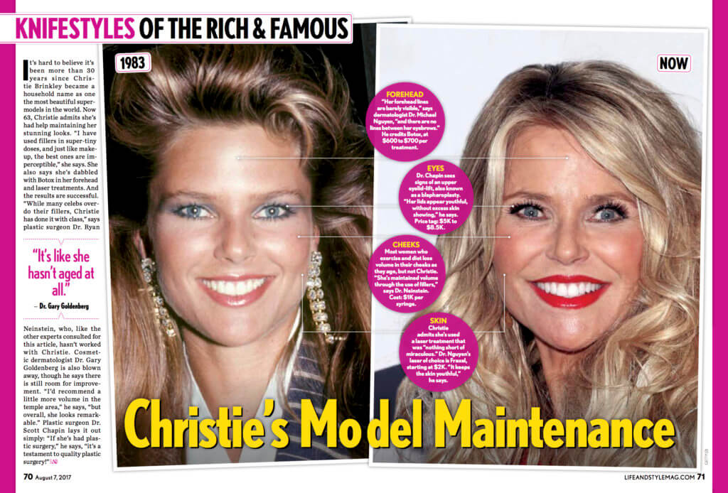 Knifestyles Of The Rich Famous Christie Brinkley Neinstein Plastic