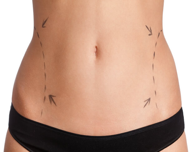 Liposuction Recovery Optimization Kit - POST OP RECOVERY