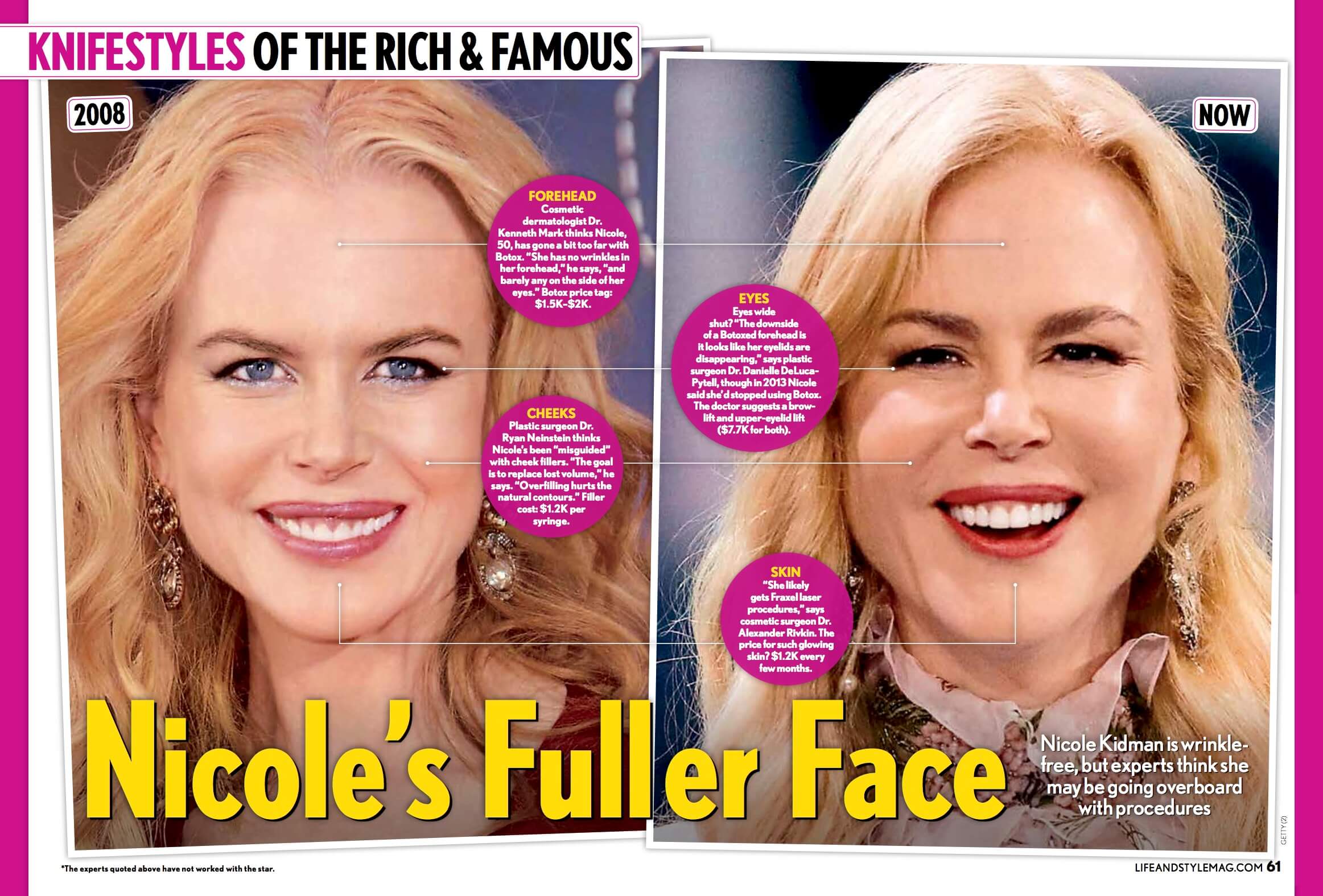 Knifestyles of the Rich and Famous Nicole Kidman Neinstein Plastic