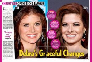 Knifestyles of the Rich & Famous: Debra Messing | Neinstein Plastic Surgery