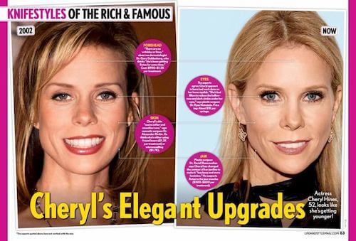 Knifestyles of the Rich & Famous: Cheryl Hines.