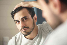 male-hair-loss