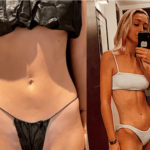 nps_before-after-lipo-360-9.21.21-min