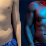 nps_male-lipo-before-after-9.27.21-min
