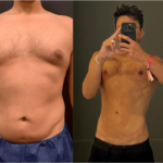 nps_before-after-lipo-360-10.24-min