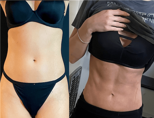 nps_before-after-lipo-360-12.14-min