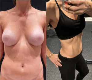 Before & After: Mom of 4