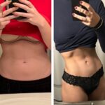 nps_before-after-lipo360-12-18