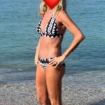 65, 9 months after breast lift with implants and tummy tuck