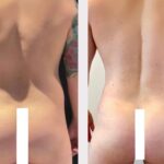 male-body-contouring-5