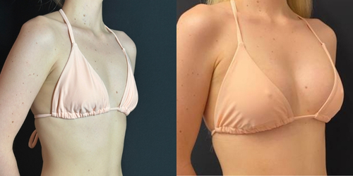 NPS-Before-After_Shannon-19